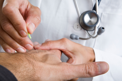 acupuncture for depression