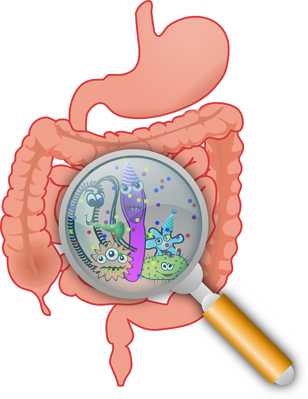 cartoon of post infectious IBS