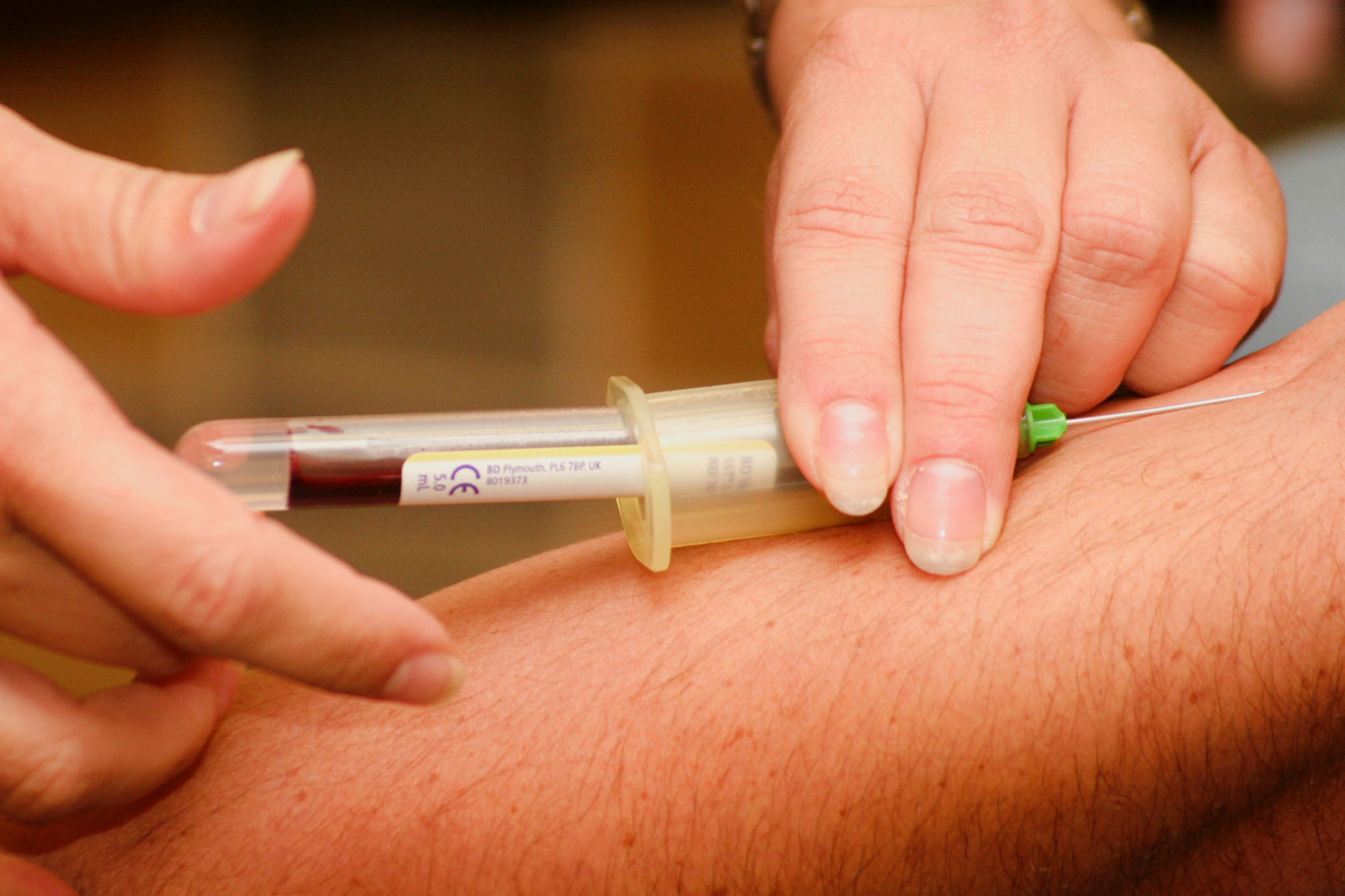 blood test for vitamin b12