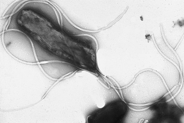 How Do You Know If You Have Helicobacter pylori?